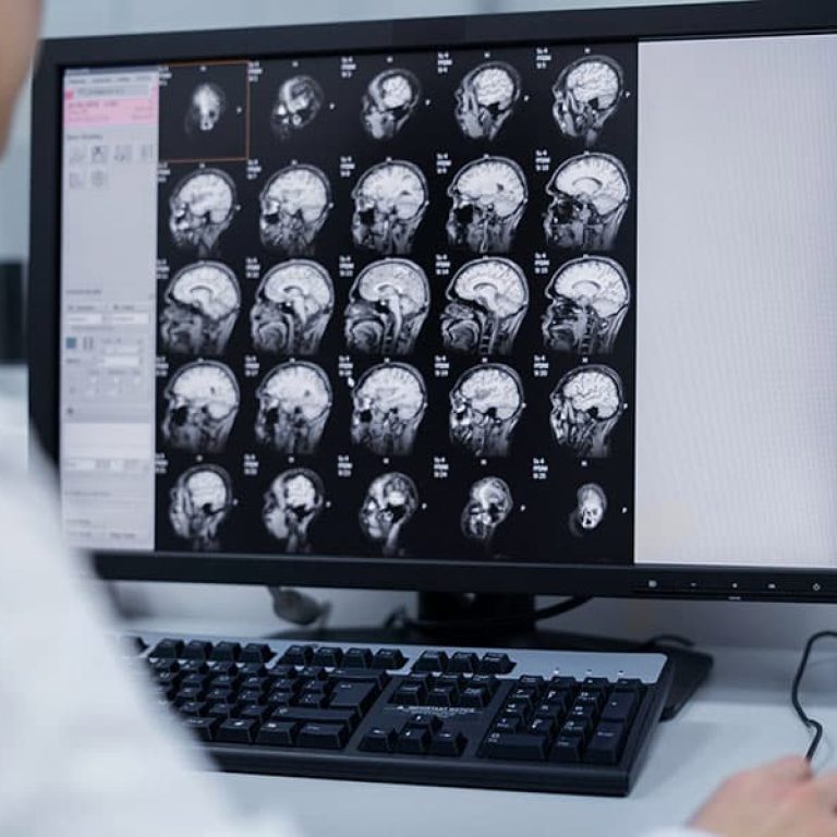 Brain-MRI-Main-Banner